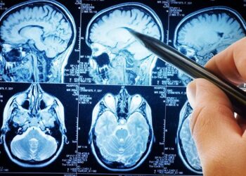 Identifican nuevos genes relacionados con la esquizofrenia