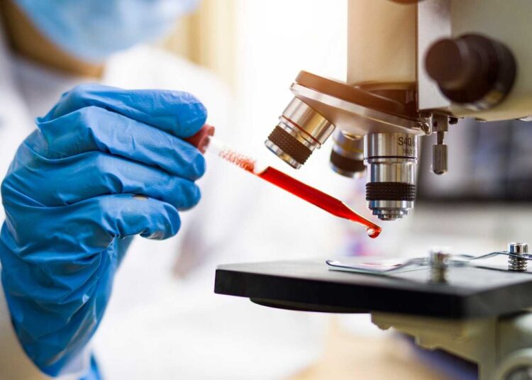 Primera mujer curada de VIH gracias a células madre de cordón umbilical