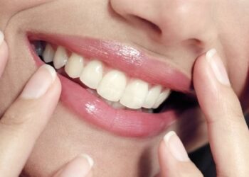 Conozca las frutas que ayudan a blanquear los dientes y combatir el sarro dental