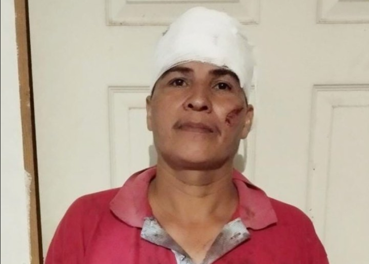 Capturado en tiempo récord: Agresor que utilizó un corvo contra su víctima ya está bajo custodia