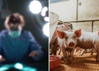 Médicos chinos trasplantan con éxito riñón genéticamente modificado de cerdo a cuerpo humano