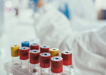 Aumentan a 17 los menores fallecidos por bacteria Klebsiella oxytoca en México