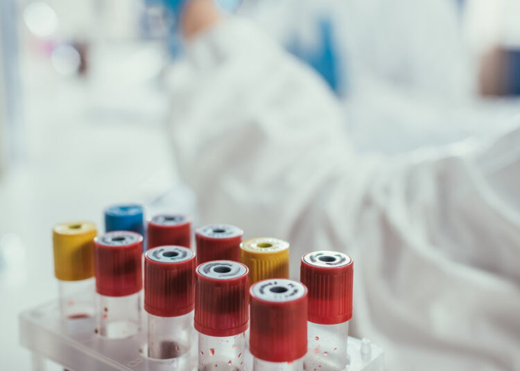 Aumentan a 17 los menores fallecidos por bacteria Klebsiella oxytoca en México