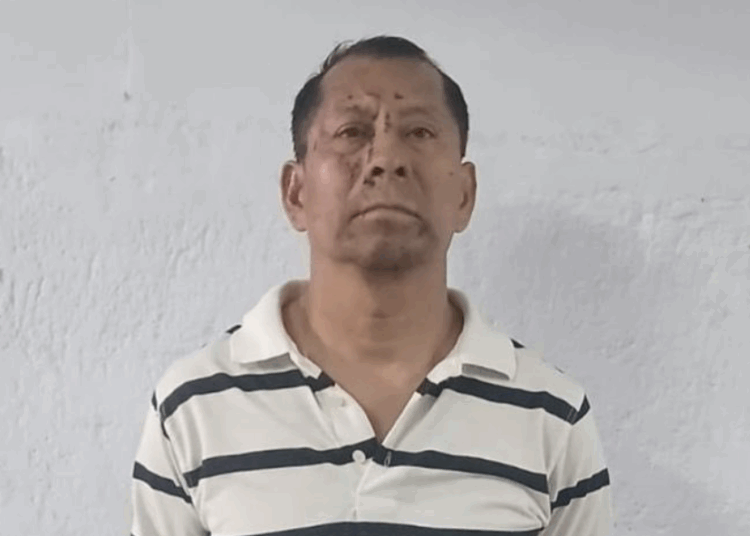 Capturan a hombre que lesionó a otro en el rostro tras dispararle durante una discusión