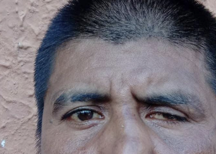 Capturado por atacar a ladrillazos a su compañero de tragos