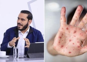 El Salvador alcanza cobertura récord del 98.4 % contra el sarampión