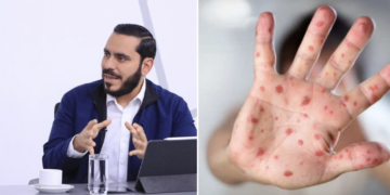 El Salvador alcanza cobertura récord del 98.4 % contra el sarampión